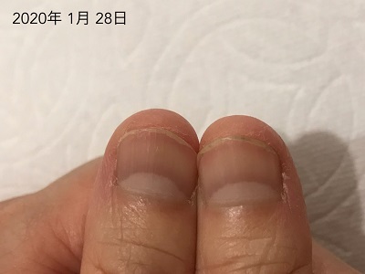 爪噛みしたくなったの 最初の2週間だけでした 広島 深爪ケア専門サロン