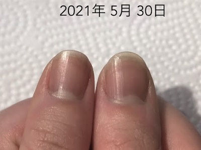 爪周りのささくれや 乾燥も変わってきます 広島 深爪ケア専門サロン