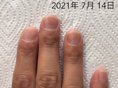 深爪も 痛いささくれも なくなり 手を眺めたくなるほど 変わっていきます 広島 深爪ケア専門サロン